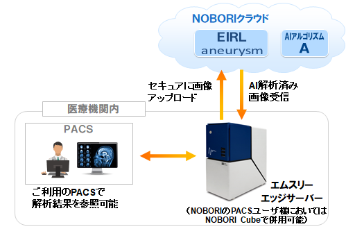 EIRL aneurysmのサービス提供開始